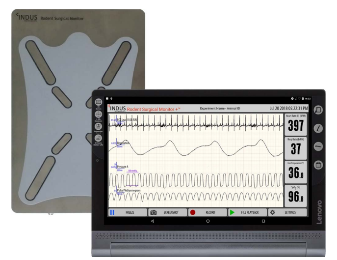 monitor de signos vitales